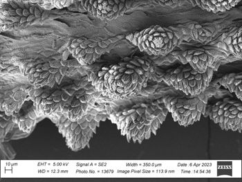 Media type: image;   Invertebrate Zoology 32029 Description: SEM image of specimen.;  Aspect: dorsal